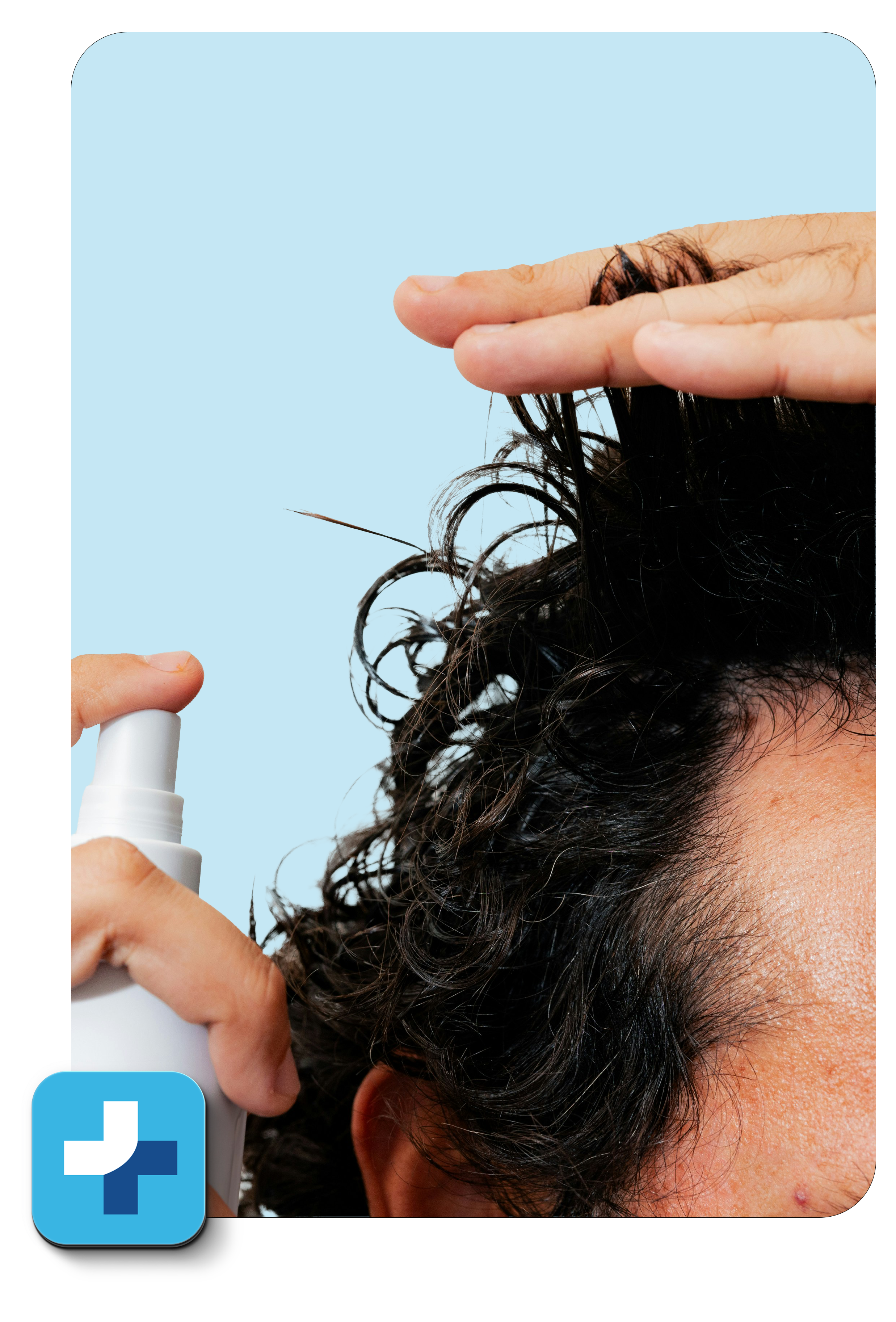 Hair Loss Graphic Hair Loss Page 1