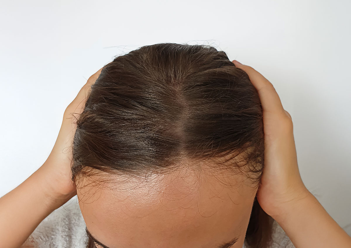 Home Page Before and Afters 4 Hair 1